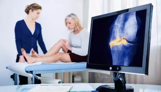 liigese artroos naisel